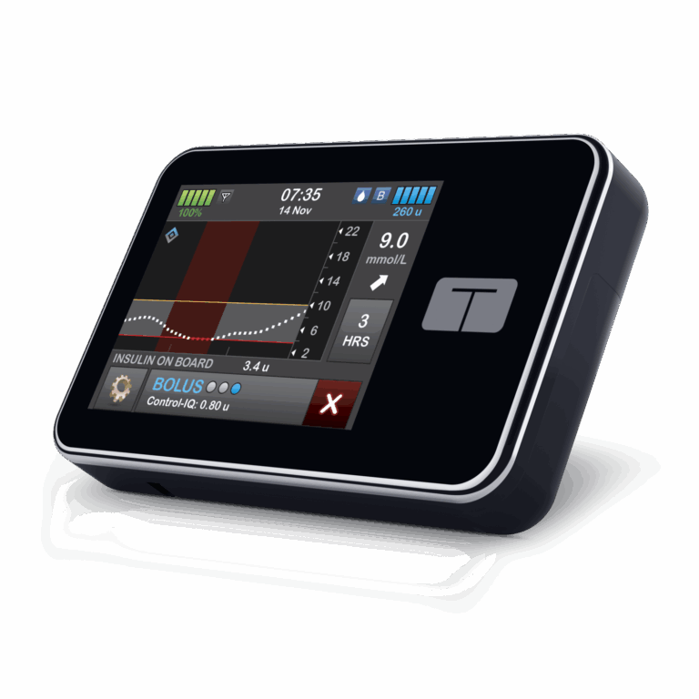 Tandem t:slim X2 Insulin Pump with Control-IQ+ technology